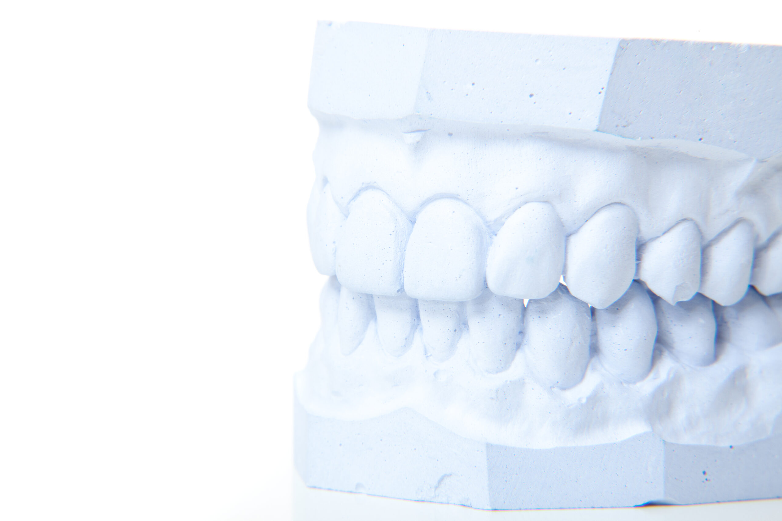 Plaster cast of perfect teeth